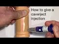 How to give a Caverject injection for ED
