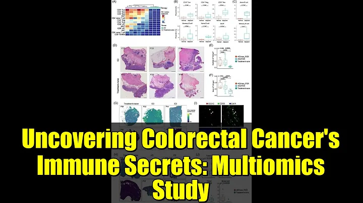 Uncovering Colorectal Cancer's Immune Secrets: Multiomics Study