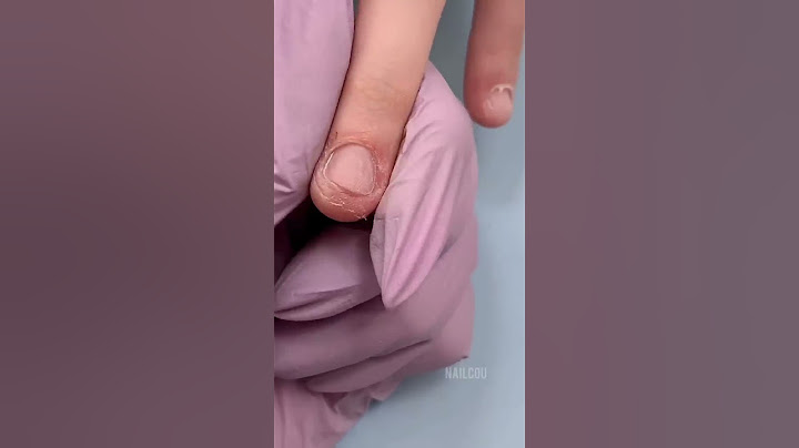 Nail Salons refused to work with her 😢