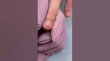 Thumbnail of Nail Salons refused to work with her 😢