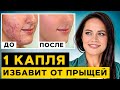 Эфирные масла ПРОТИВ АКНЕ! / Как УБРАТЬ прыщи с помощью ОДНОГО средства?