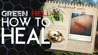 Green Hell | How to HEAL any condition!