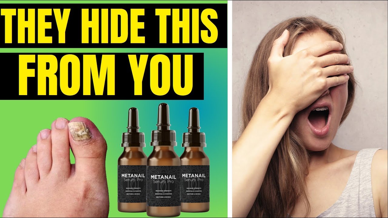 METANAIL SERUM PRO REVIEW – MetaNail Complex ⚠️ Review ❌ (WARNING!!) ❌ Does MetaNail Complex work?