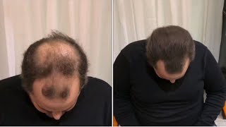 Boldify vs  Hair3 Fibers