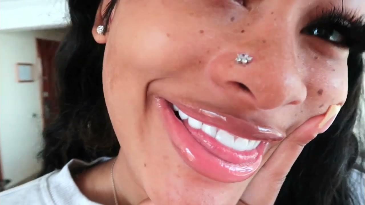 I Got VEENERS in Dominican Republic Dental Emporium VLOG YouTube