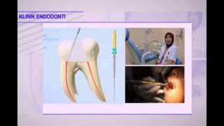 Klinik Endodonti - RSKGM Kota Bandung