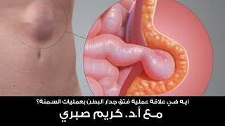 ايه هي علاقة عملية فتق جدار البطن بعمليات السمنة؟ مع أ.د. كريم صبري.