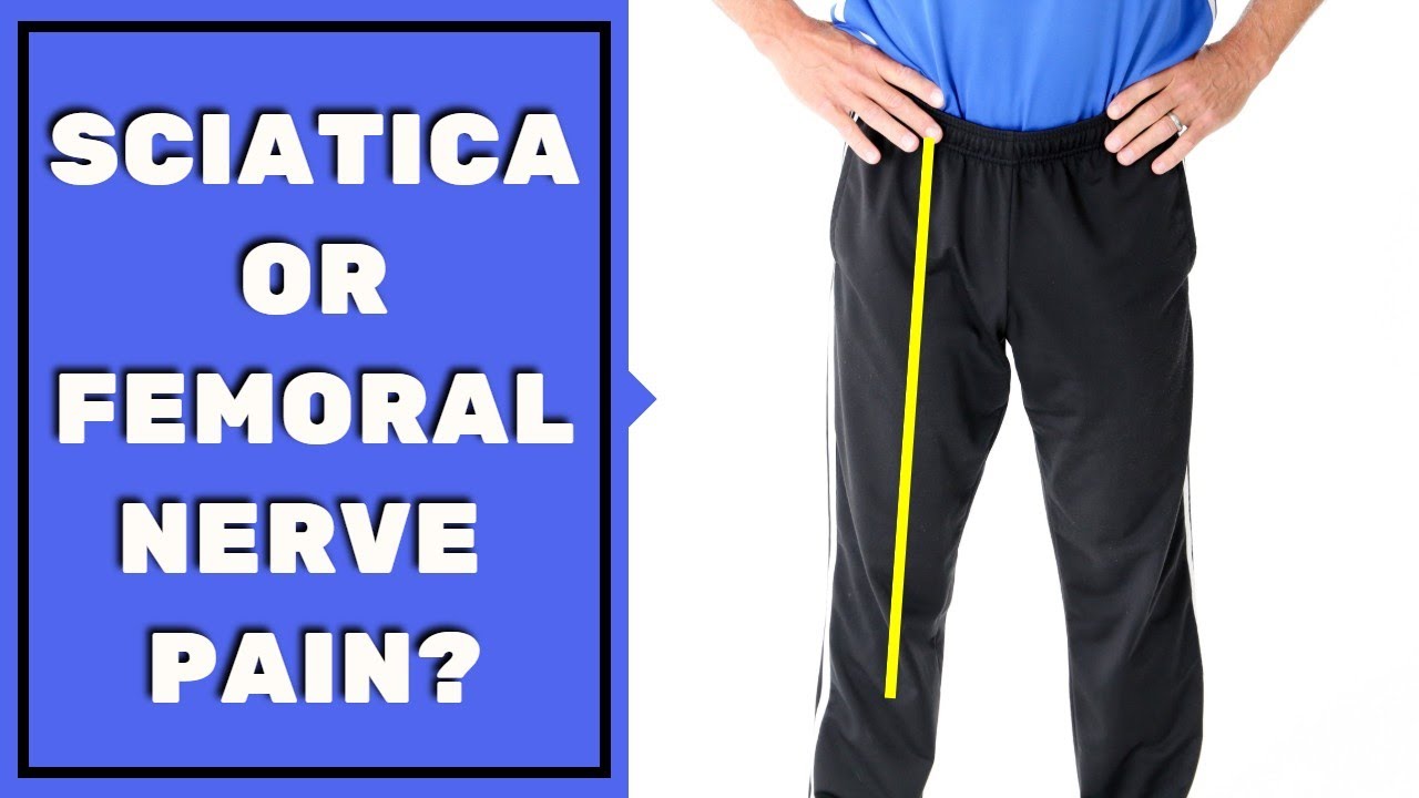 Is Leg Pain Sciatica Or Femoral Nerve Pain? Must See To Assess  Stop Pain