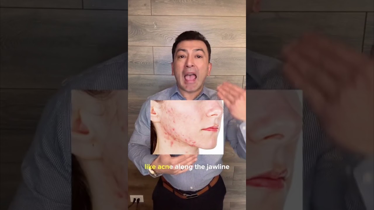 Insulin Resistance and How it Affects Your Skin 