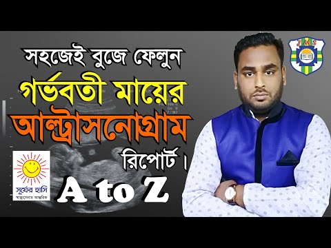 ভিডিও: বোঝার কার্যক্রম কি?