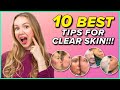 10 Effective Tips For Clear Skin (Best Acne Advice)