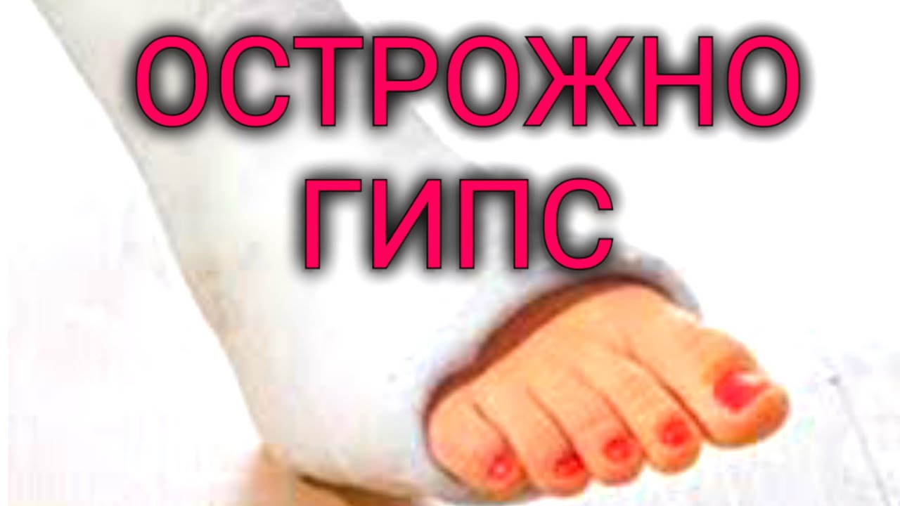 Инвалида заставили снимать гипс кусачками в самарской поликлинике Новости общест