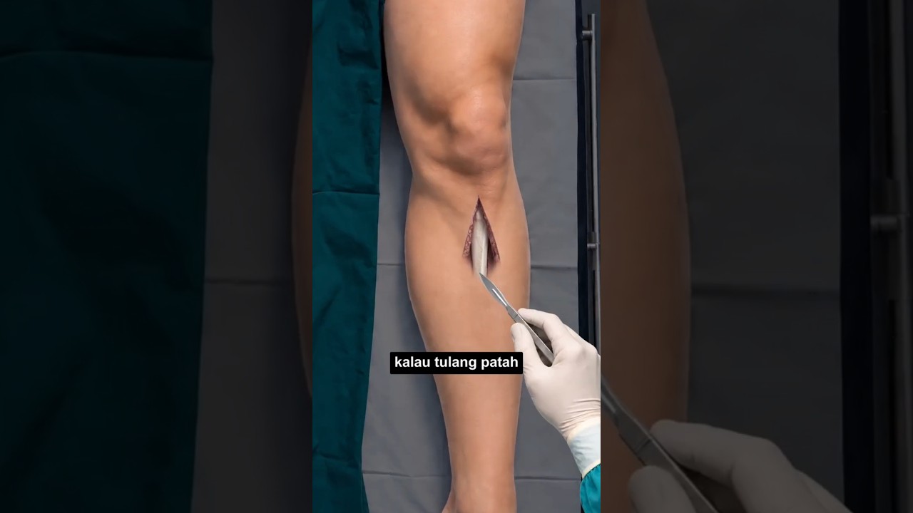 Original Title & Thumbnail