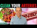 Can a nutritarian diet remove calcified plaque in arteries  dr joel fuhrman