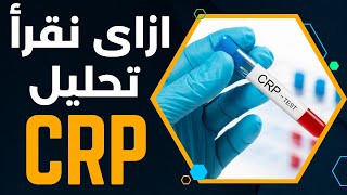 ازاي نقرأ تحليل CRP | ايه هي فائده تحليل C reactive protein ؟