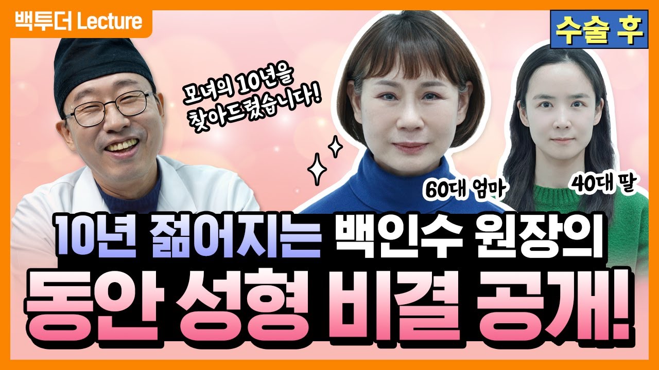 [60대] 상·하안검+이마거상+안면거상!  ※20년 삭제 ⭐특급 노하우⭐ Part 2※