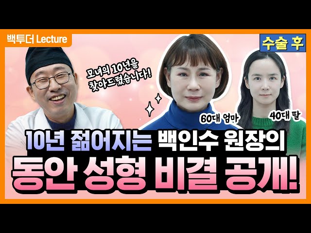 [60대] 상·하안검+이마거상+안면거상!  ※20년 삭제 ⭐특급 노하우⭐ Part 2※