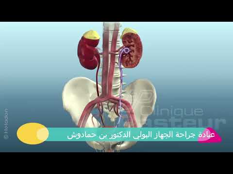انتفاخ الكلية