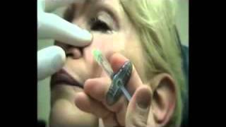 Dr. Miller - Botox Injections - New York, NY