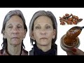 Mix cloves with water to look 10 years younger than your age,🌱natural botox