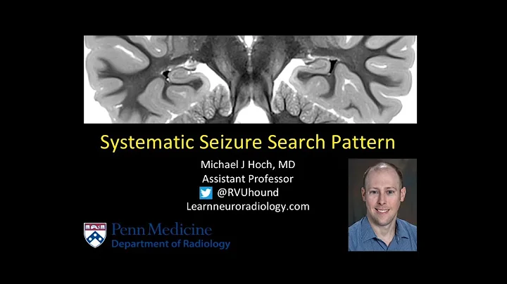 Penn Radiologist Dr Michael Hoch Reviews Seizure S...