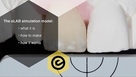 The eLAB Simulation Model for dental shade matching: What it is, how to make one and how it works!