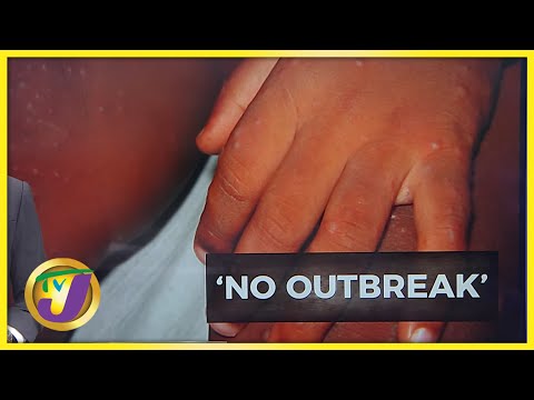 No Hand, Foot & Mouth Outbreak | TVJ News - Mar 4 2022