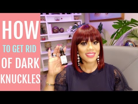 Video: Dark Knuckles: Årsaker, Behandlinger Og Naturlige Midler
