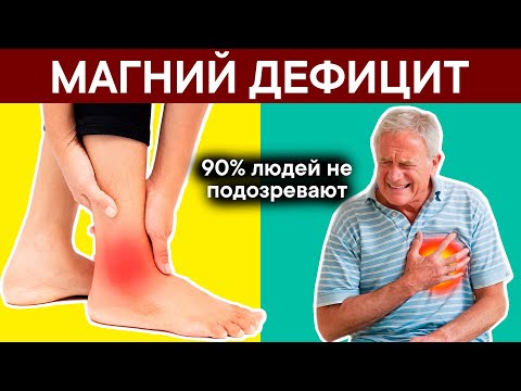 Дефицит МАГНИЯ, 9 острых признаков. + 5 лучших продуктов для ВОСПОЛНЕНИЯ дефицита МАГНИЯ