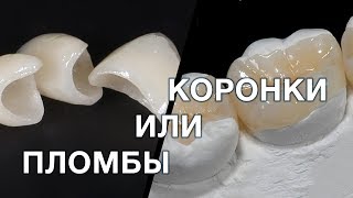 Пломба или коронка? Что лучше выбрать и в какой ситуации ?