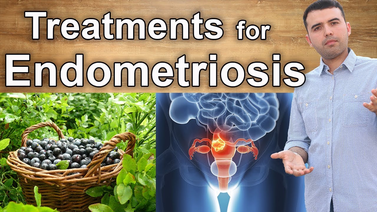 Natural Treatments for Endometriosis – Home Remedies, Supplements ...