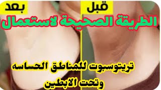 تفتيح المناطق الحساسه في 4 أيام بكريم تريتوسبوت الى طبقتي هذه الطريقة#تريتوسبوت#تفتيح