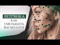 ВЕТРЯНКА У ВЗРОСЛЫХ / КАК Я УМЕНЬШИЛА ВЫСЫПАНИЯ И БЫСТРО ВЫЛЕЧИЛАСЬ