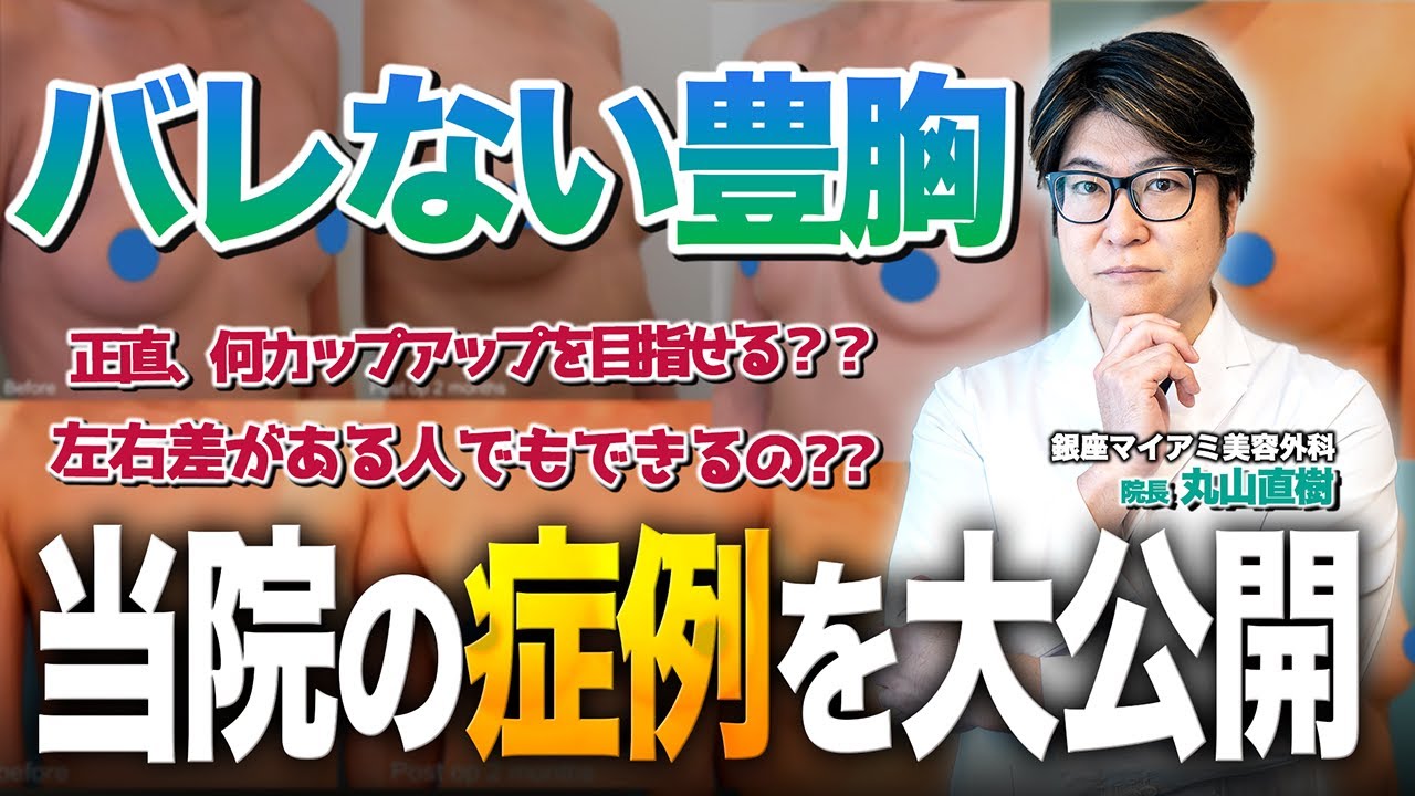 銀座マイアミ美容外科の「バレない豊胸」を計7つ症例を交えて徹底解説します！