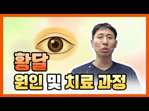 황달 증상 및 원인, 어떻게 해야 나아질 수 있을까?