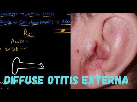 Diffuse Otitis Externa