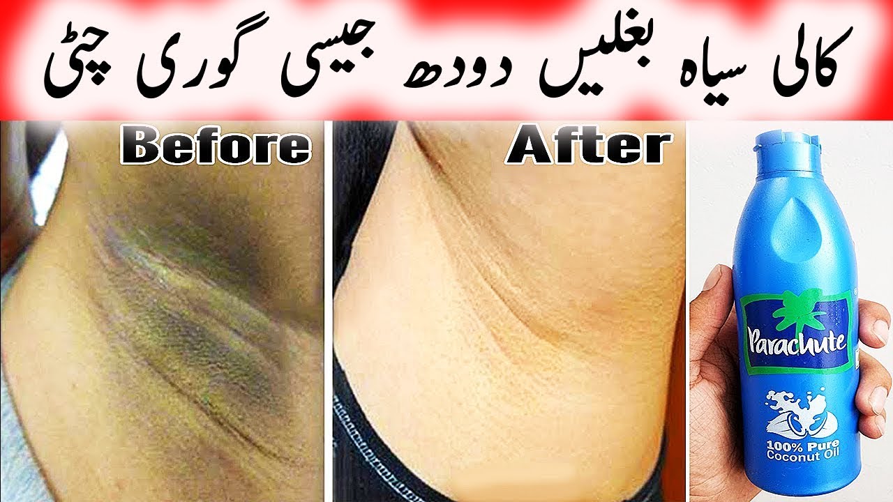 Challenge To Lighten Dark Underarms In 10 Minutes Permanent Skin