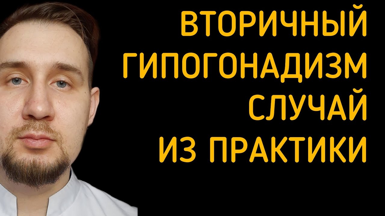 Лечение вторичного гипогонадизма кломифеном. Клинический случай. # ...