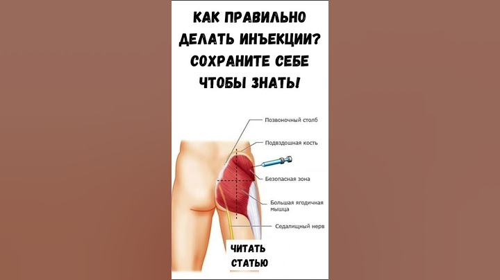 Как правильно делать инъекции? #здоровье #польза #рекамендация