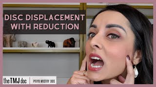 Disc Displacement With Reduction - Priya Mistry, DDS (the TMJ doc) #tmj #jawpopping #jawclicking
