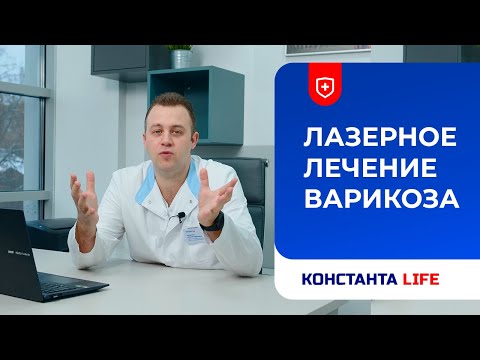Лазерное лечение варикоза: причины, лечение, профилактика - подробное видео