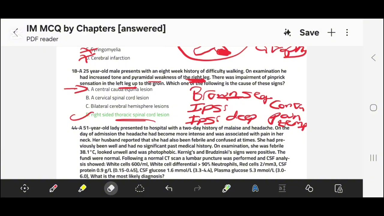 Internal Medicine: Neurology MCQs (Part 2/2)