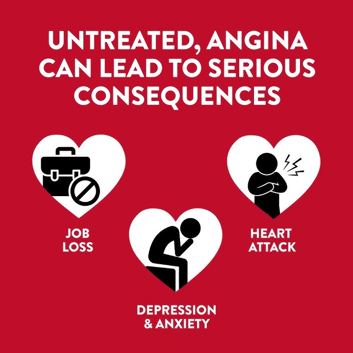 Angina is more common than you think, and the symptoms might surprise you
