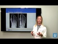 Bunions & Hammertoes - Joan Williams, MD | UCLAMDCHAT Webinars