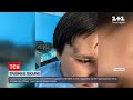 Новини України: у Миколаєві 8-річного хлопчика побила медпрацівниця психлікарні