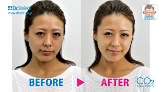 Dr. Select Co2 Gel Pack 使用指南