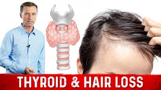 The Ketogenic Diet, Your Thyroid and Hair Loss