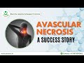 Avascular necrosis avn patient finds relief stem cell treatment at stemrx