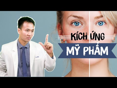 Video: Làm Thế Nào để Thoát Khỏi Kích ứng