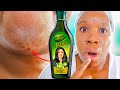 I Used AMLA OIL On My Skin Everyday FOR 12 DAYS